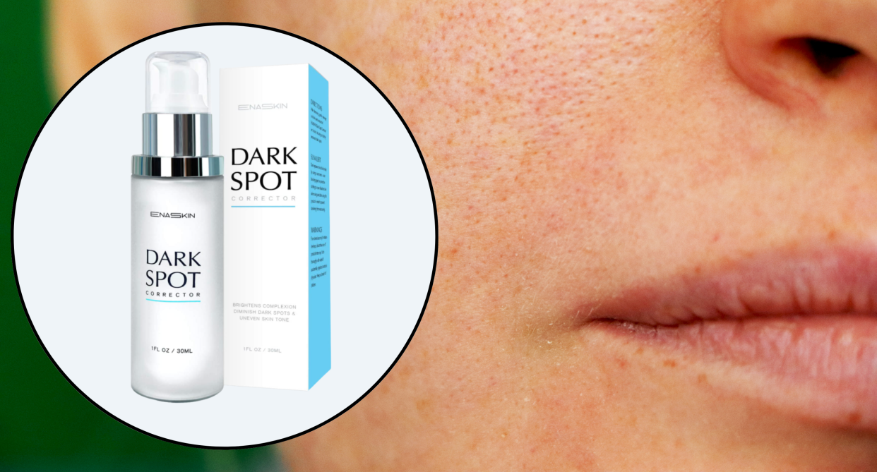 close up of woman's cheek and lip, dark spot corrector for acne marks amazon canada, dark spots