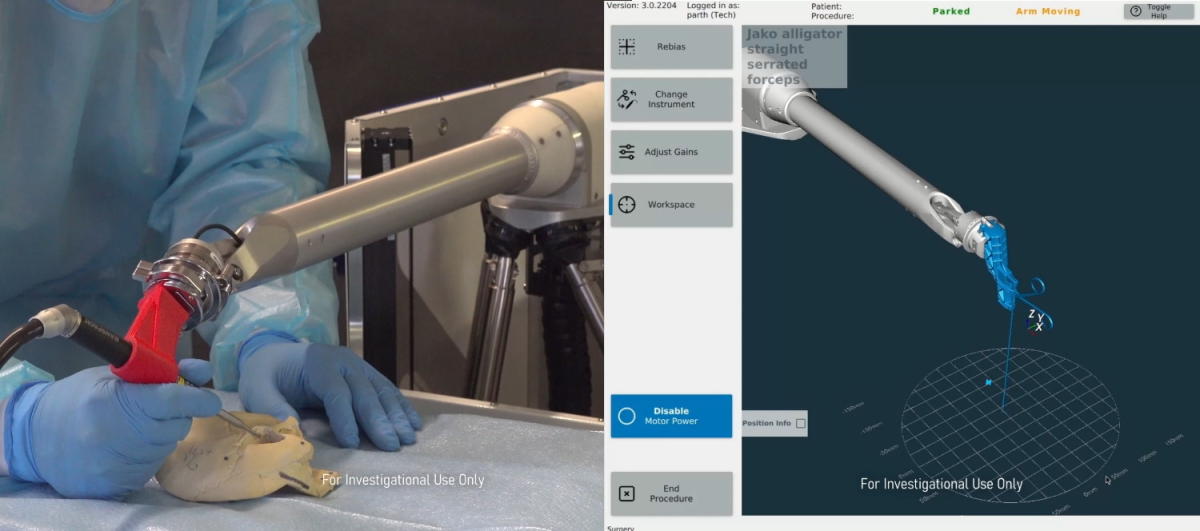 Galen Robotics looks to assist ENT surgeons with new bot and $15M round - Image