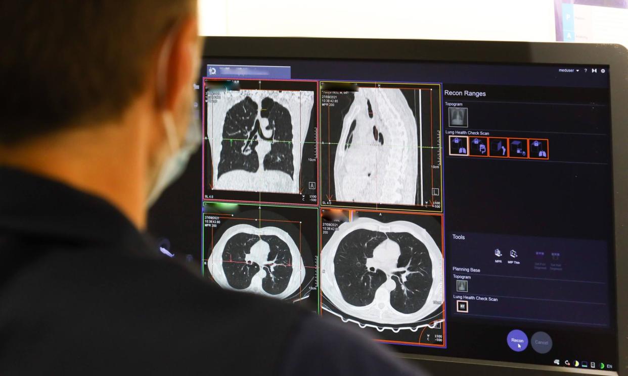 <span>An NHS member of staff looks at the results of a lung scan. The study calculated that between April and July 2020, diagnosis of lung cancer dropped by 16%.</span><span>Photograph: NHS England/PA</span>