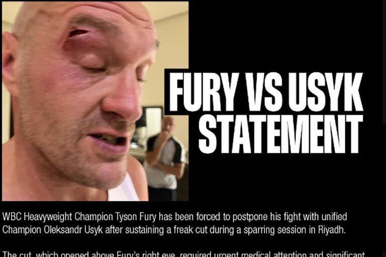 El ojo derecho de Fury luce inflamado, tal como se observa en el comunicado oficial que publicaron los organizadores de la fallida pelea