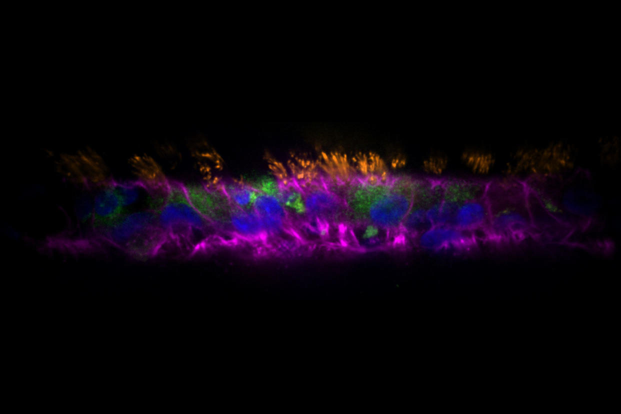 Human airway epithelial cells in airgel tissue Tamara Rossy (EPFL)