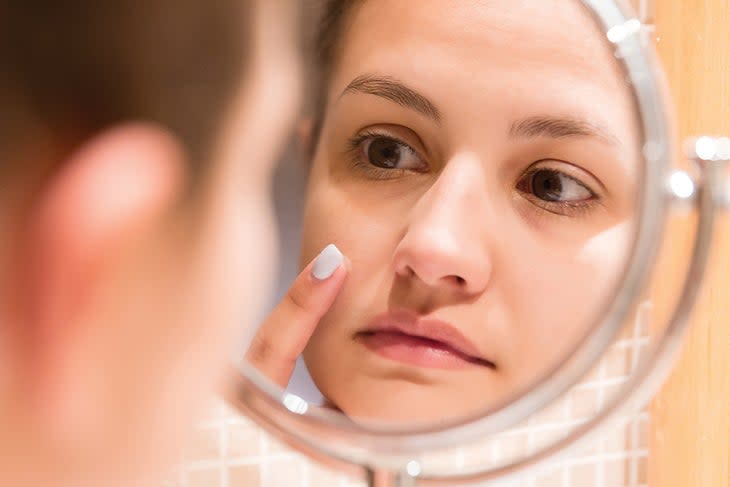 Woman treating pimple in the mirror