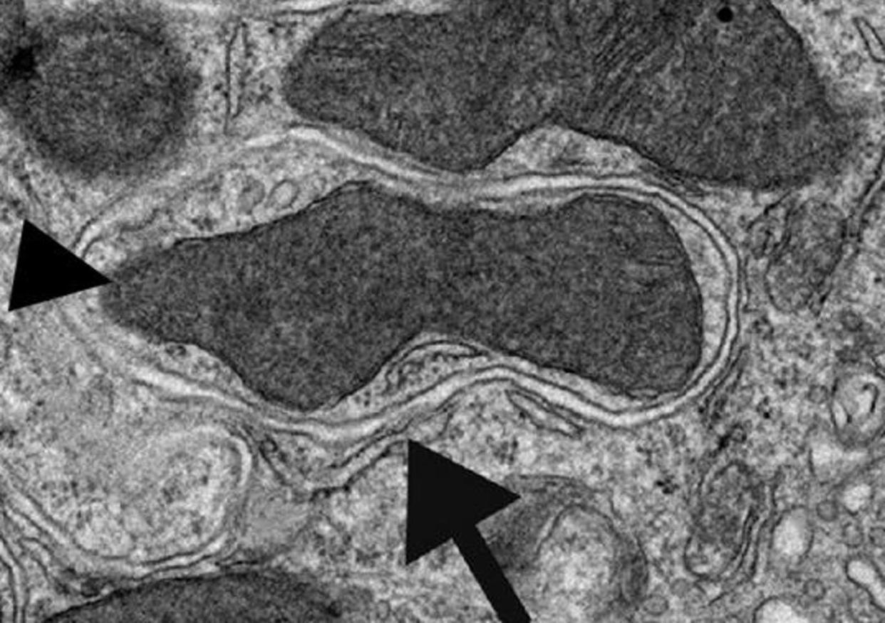 <span class="caption">Imagen de microscopía electrónica de transmisión de una vesícula autofágica en el riñón de un ratón.</span> <span class="attribution"><a class="link " href="https://commons.wikimedia.org/wiki/File:Autophagy_in_plants.jpg" rel="nofollow noopener" target="_blank" data-ylk="slk:Wikimedia Commons / International Journal of Plant Genomics;elm:context_link;itc:0;sec:content-canvas">Wikimedia Commons / International Journal of Plant Genomics</a>, <a class="link " href="http://creativecommons.org/licenses/by-sa/4.0/" rel="nofollow noopener" target="_blank" data-ylk="slk:CC BY-SA;elm:context_link;itc:0;sec:content-canvas">CC BY-SA</a></span>