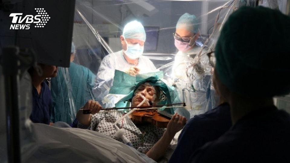 英國1名小提琴日前動開顱手術，手術過程中她拉著小提琴演奏歌曲。(圖／達志影像路透社)