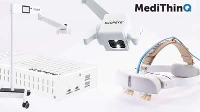 The MediThinQ SCOPEYE 3D Micro Surgery Solution