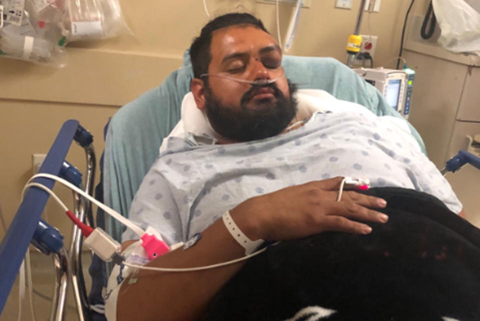 Alex Coreas, of Texas, is seen in a hospital bed recovering after he was struck by lightning.