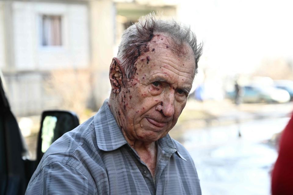 An injured man stands by a vehicle of an Emergency unit to receive medical assistance after bombings on the eastern Ukraine town of Chuguiv on Feb. 24, 2022, as Russian armed forces are trying to invade Ukraine from several directions, using rocket systems and helicopters to attack Ukrainian position in the south, the border guard service said.