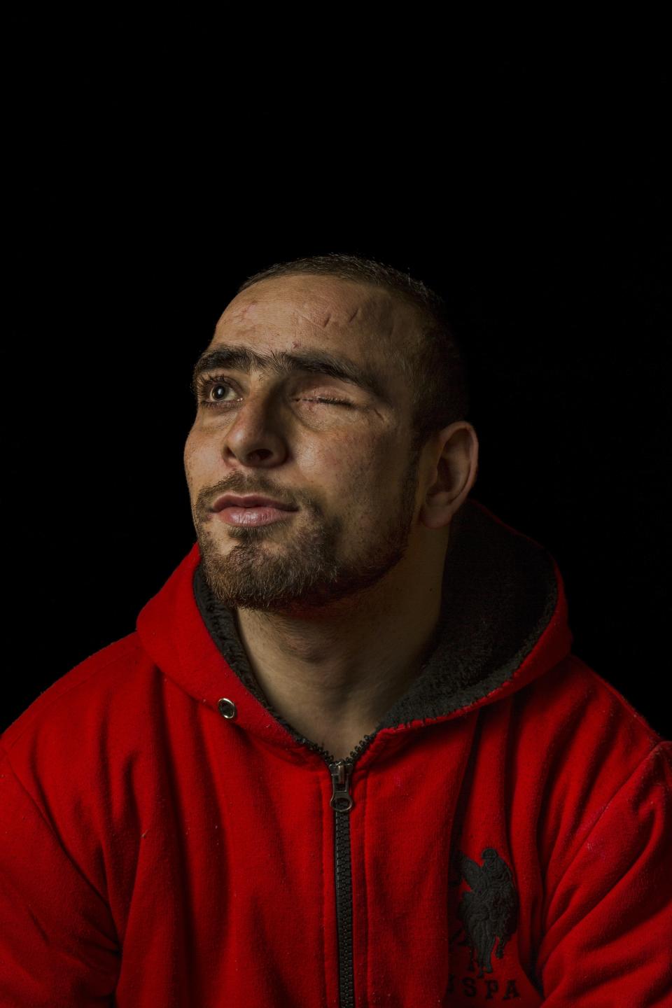 In this Dec. 1, 2016 file photo, Danish Rajab Jhat, 24, who lost an eye to shotgun pellets, poses for a portrait in Srinagar, Indian-controlled Kashmir. A prominent rights group in Indian-controlled Kashmir is advocating United Nations to establish a commission of inquiry to probe endemic use of torture by government forces who have faced decades long anti-India uprising in the disputed region. (AP Photo/Bernat Armangue, File)