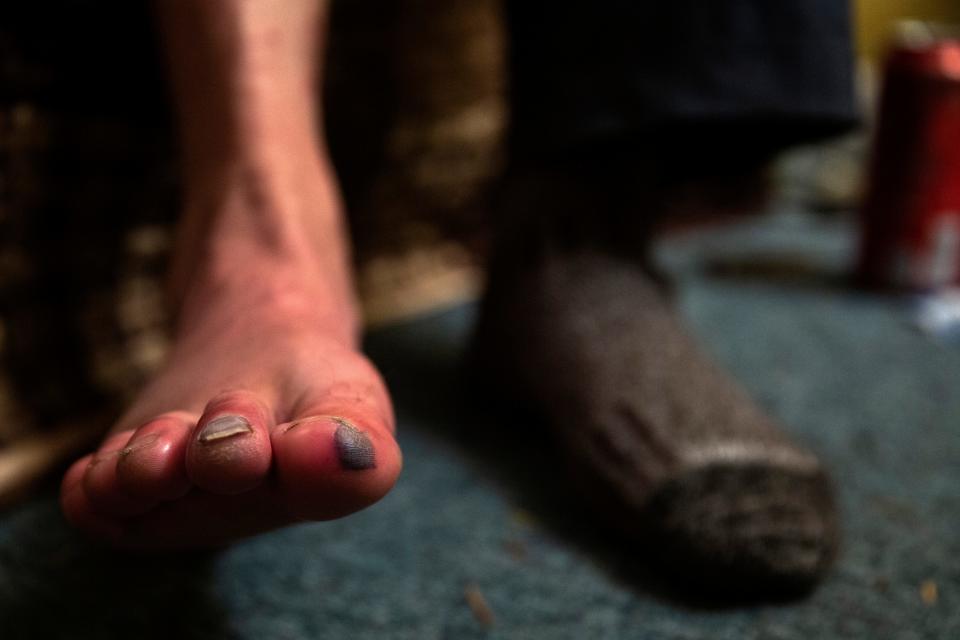 After being lost in blizzard conditions in the Willamette National Forest and eventually found by a Search and Rescue team, Robb Campbell recovers from minor frost bite at the All Seasons Motel in Detroit, Oregon, on October 19, 2019. Campbell has been hiking the Pacific Crest Trail since May, and intends to finish the trail.