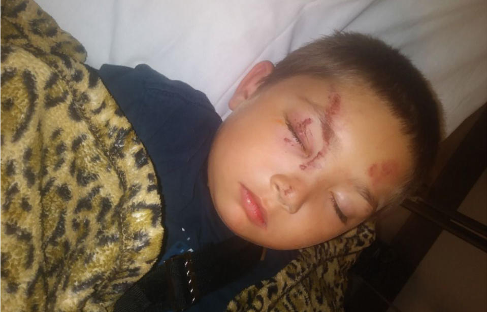 Olympia Washington US 6 year old boy Carter English attacked stopping bullies.