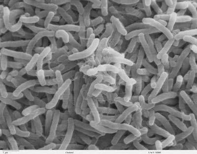 <em>Vibrio cholerae</em>, la bacteria que causa el cólera. <a href="https://commons.wikimedia.org/wiki/File:Cholera_bacteria_SEM.jpg" rel="nofollow noopener" target="_blank" data-ylk="slk:Wikimedia Commons;elm:context_link;itc:0;sec:content-canvas" class="link ">Wikimedia Commons</a>