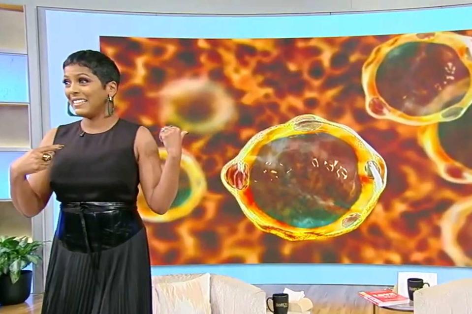 <p>Tamron Hall Show/YoutTube</p> Tamron Hall showing off the parasite that was found in her gut