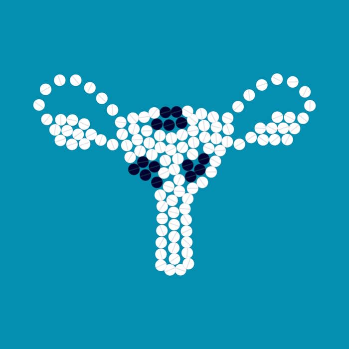 Illustration of a uterus formed by white and black pills, used to symbolize uterine fibroids