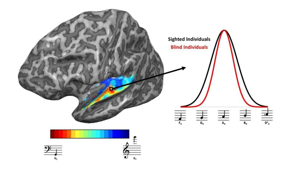 IAMGEN Las regiones en colores cálidos representan regiones del cerebro con mayor respuesta a tonos bajos | Kelly Chang / U. de washington