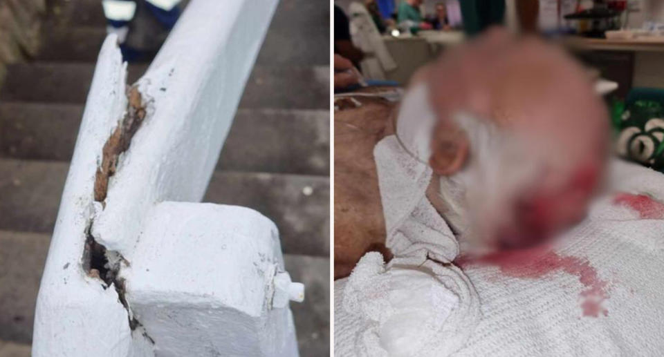 Left: Broken white railing in Malabar, Sydney. Right: Francis Hutchen laying on hospital bed with bleeding head. 