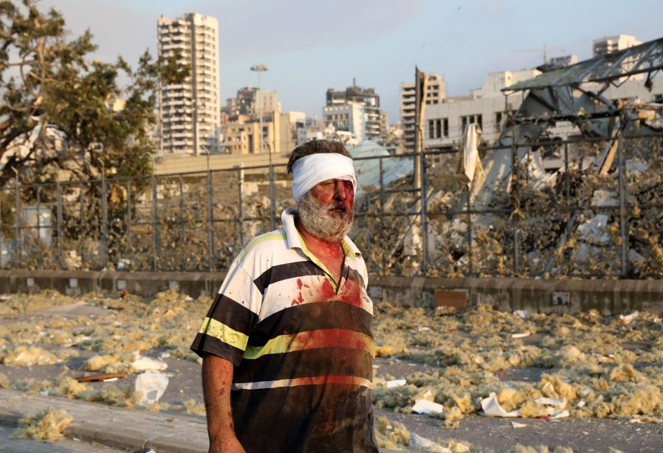 A wounded man walks near the scene of the explosion in Beirut. (Photo: ANWAR AMRO via Getty Images)