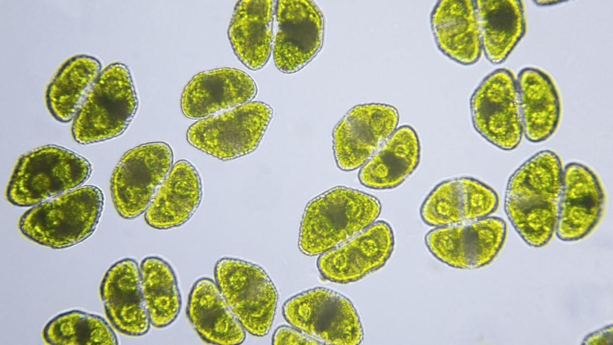 algae, cosmarium turpinii, micrograph