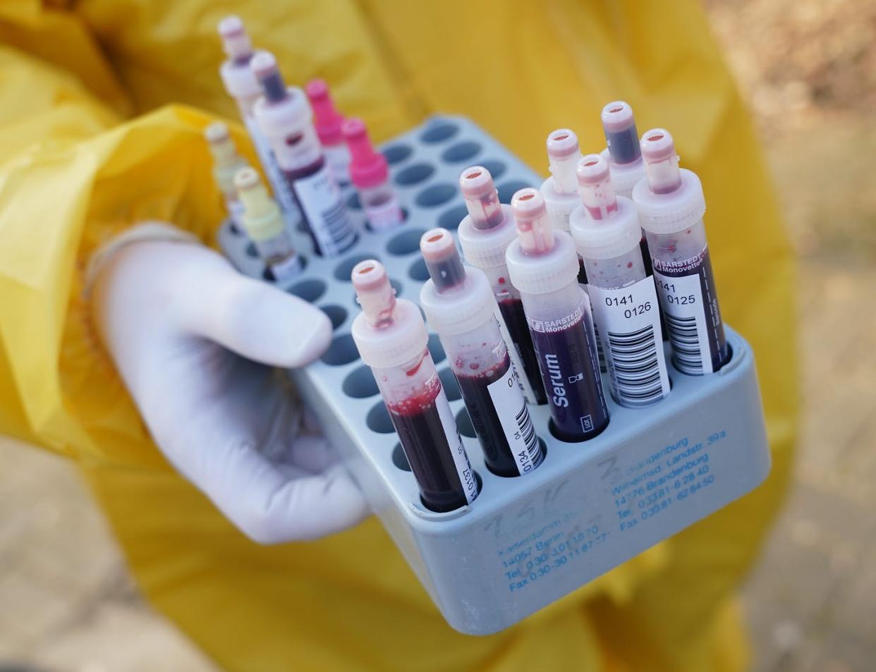 <span class="caption">Testing blood provides answers about who has been infected.</span> <span class="attribution"><a class="link " href="https://www.gettyimages.com/detail/news-photo/medical-volunteer-dressed-in-a-protective-suit-and-gloves-news-photo/1215101935" rel="nofollow noopener" target="_blank" data-ylk="slk:Sean Gallup/Getty Images News via Getty Images;elm:context_link;itc:0;sec:content-canvas">Sean Gallup/Getty Images News via Getty Images</a></span>