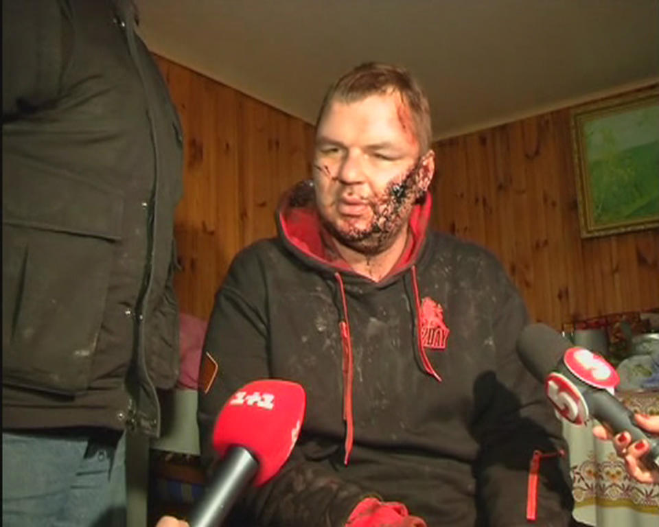 Bulatov, 35, one of the leaders of anti-government protest motorcades called 'Automaidan', speaks to journalists after being found near Kiev