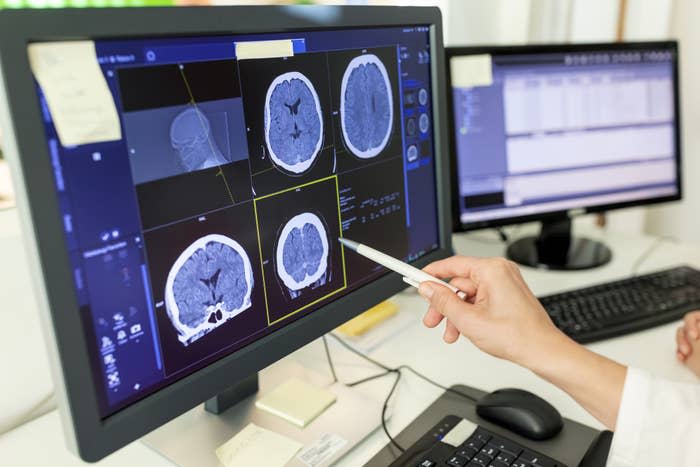 A hand points at a brain scan on a computer monitor, highlighting an abnormality. Another monitor in the background displays patient data