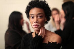 Winnie Harlow backstage