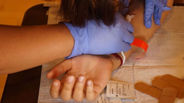 PHOTO: A medical worker administers a dose of the monkeypox vaccine to a recipient at a monkeypox vaccination site in Los Angeles, on Aug. 25, 2022.  (Xinhua News Agency via Getty Images)