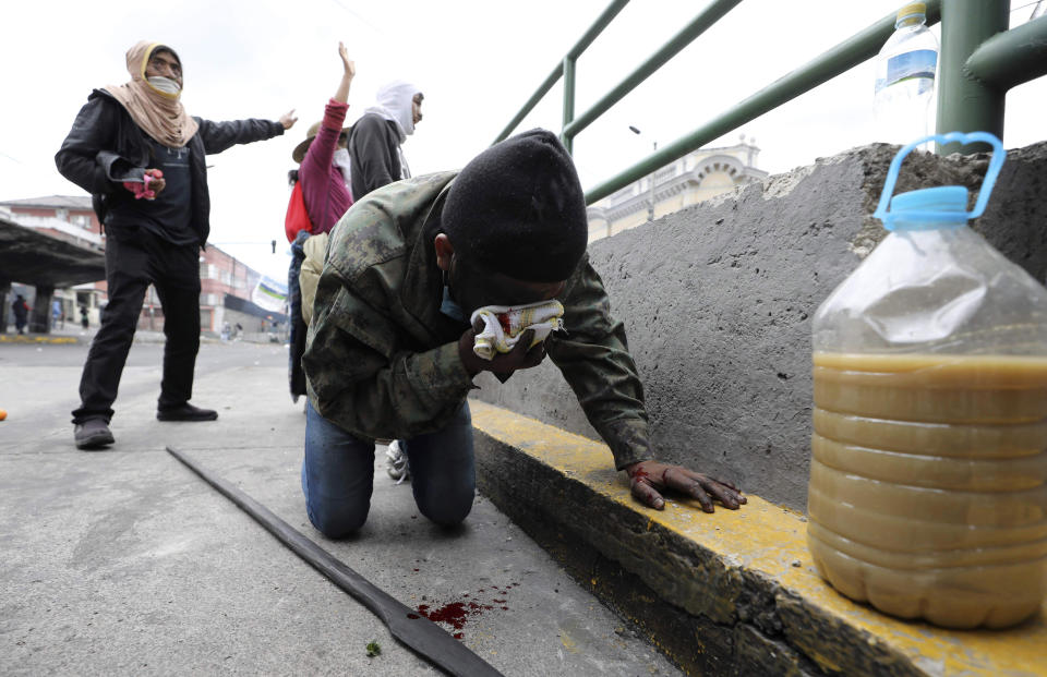An injured anti-government demonstrator holds a rag onto his bleeding face during clashes with police in Quito, Ecuador, Friday, Oct. 11, 2019. Protests, which began when President Lenin Moreno's decision to cut subsidies led to a sharp increase in fuel prices, have persisted for days. (AP Photo/Fernando Vergara)