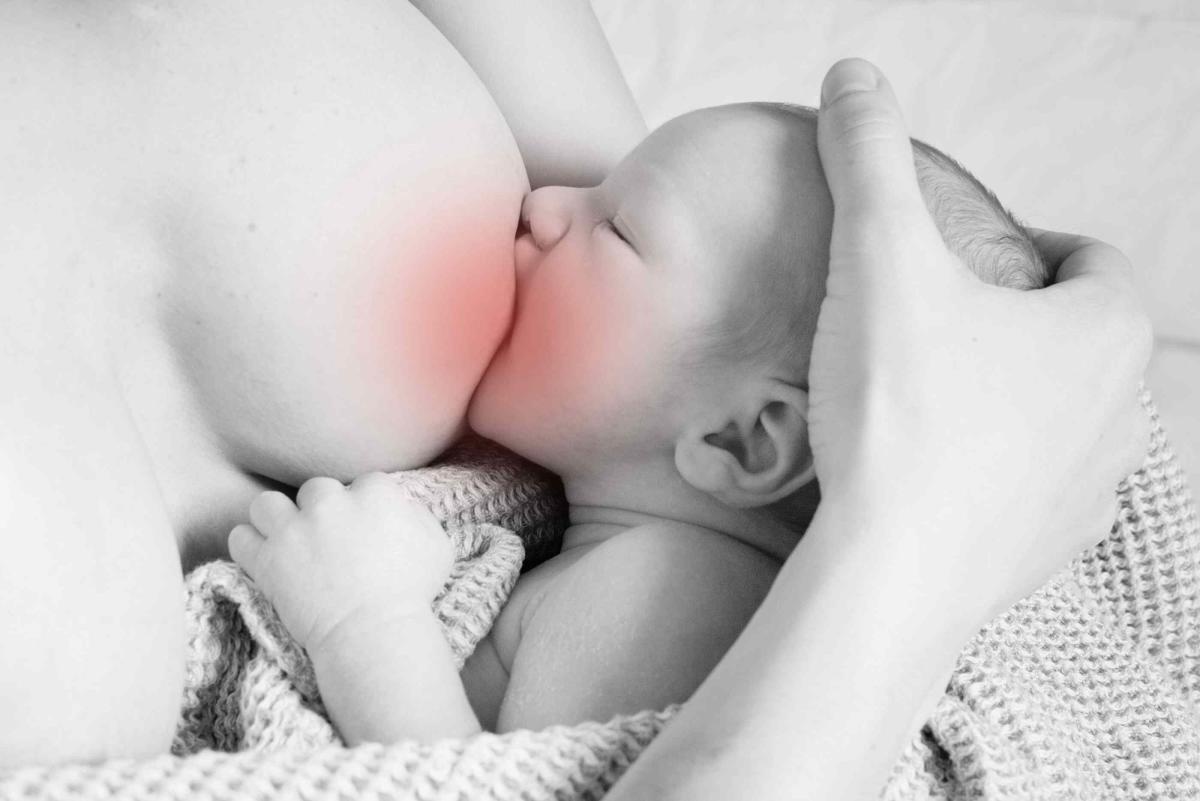 A Pain in the Boob: Breastfeeding and Thrush - Exclusive Pumping