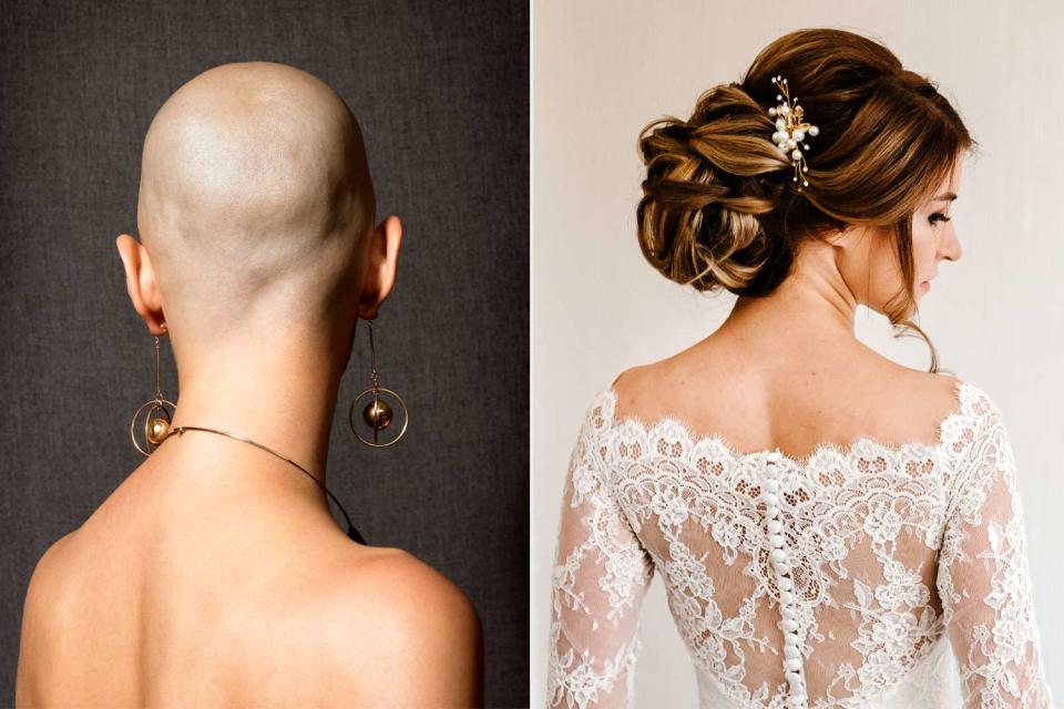 <p>Getty</p> A bride has demanded her bald sister wear a wig on her wedding day