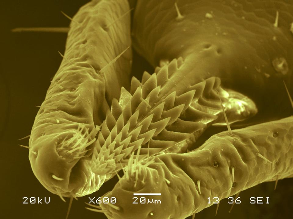 <span class="caption">A closeup of a tick’s mouth parts under an electron microscope shows the barbs that allow it to hang on after it penetrates skin.</span> <span class="attribution"><a class="link " href="https://biology.richmond.edu/research/research-labs/brinkerhoff-lab.html" rel="nofollow noopener" target="_blank" data-ylk="slk:Fernando Otalora-Luna/University of Richmond;elm:context_link;itc:0;sec:content-canvas">Fernando Otalora-Luna/University of Richmond</a>, <a class="link " href="http://creativecommons.org/licenses/by-sa/4.0/" rel="nofollow noopener" target="_blank" data-ylk="slk:CC BY-SA;elm:context_link;itc:0;sec:content-canvas">CC BY-SA</a></span>