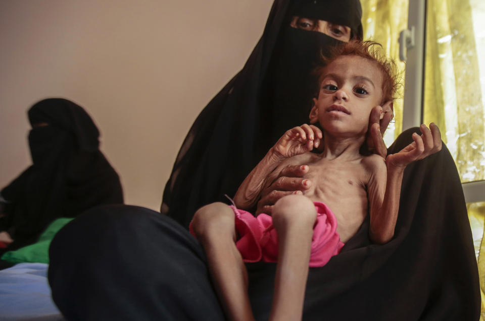 Fotografía de archivo del 1 de octubre de 2018 de una mujer cargando a un niño desnutrido en el Centro de Salud Aslam en Hajjah, Yemen. (AP Foto/Hani Mohammed, Archivo)