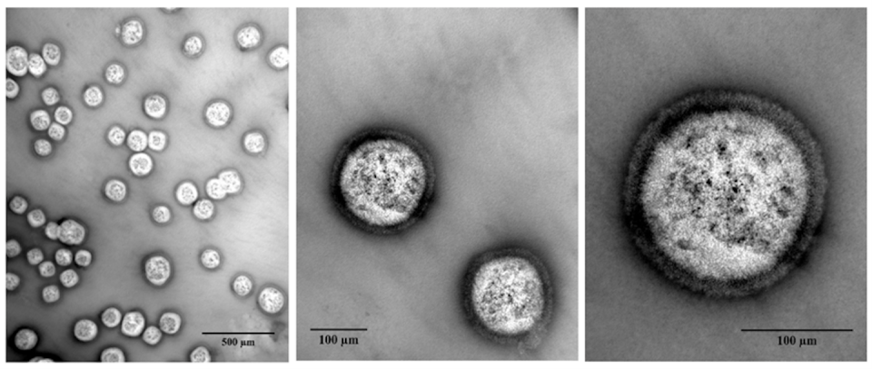 Imágenes de microscopía electrónica de transmisión (TEM) que muestran nanotransportadores de lignina-quitosano cargados con un extracto de rubia (<em>Rubia tinctorum</em>) a diferentes aumentos. Author provided