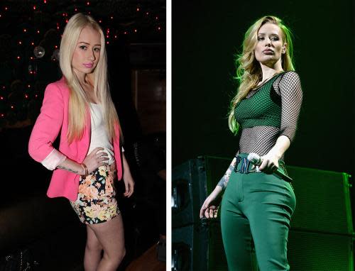 Iggy Azalea Admits 'I Got Bigger Boobs Four Months Ago