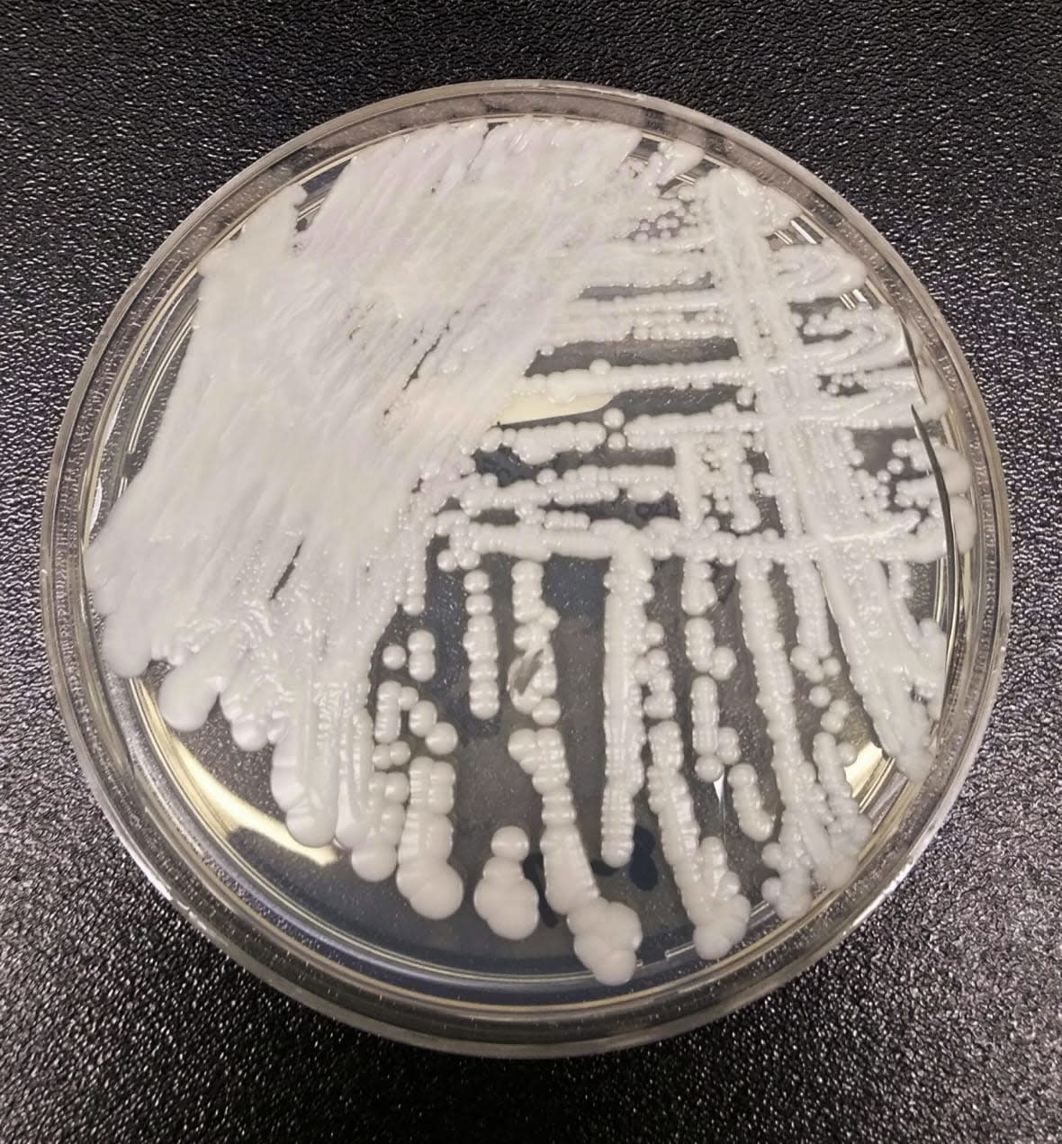 A strain of Candida auris cultured sits in a petri dish at a Centers for Disease Control and Prevention laboratory. (Shawn Lockhart/Centers for Disease Control and Prevention via AP, File)