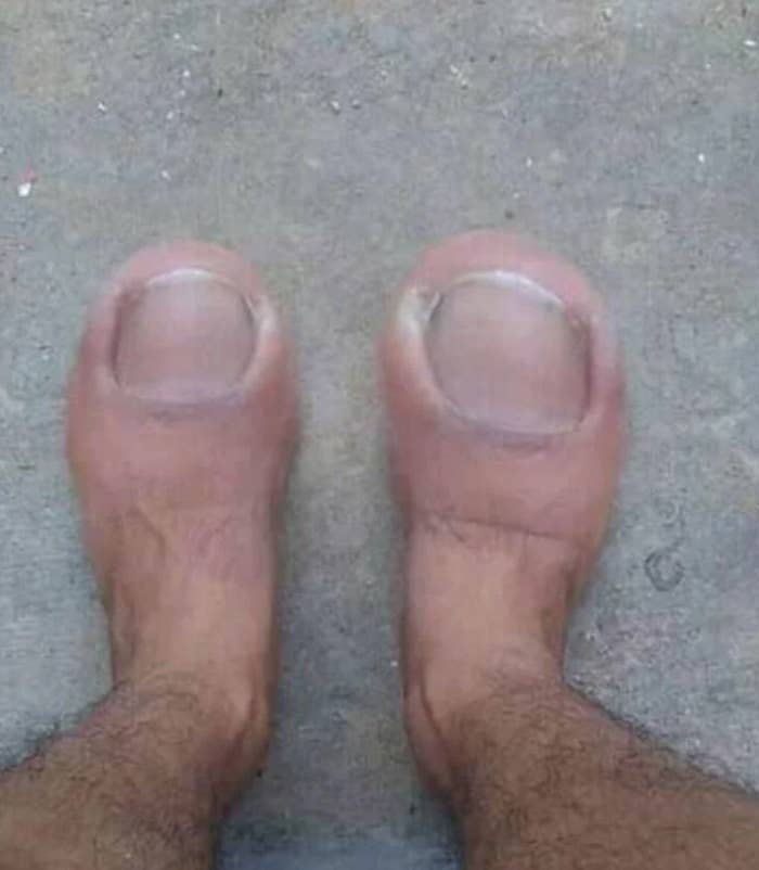 A person's feet photoshopped to look like large toes