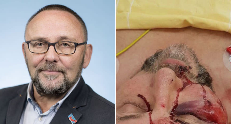 Frank Magnitz was hospitalised after being beaten (Pictures: AP/AfD)