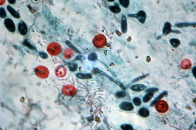 Cryptosporidium Oocysts