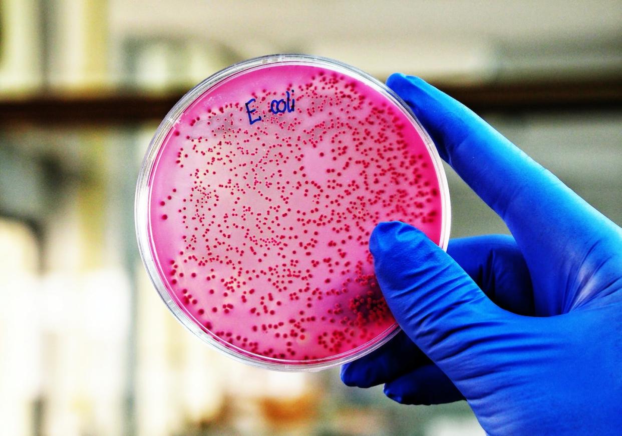 <a href="https://www.shutterstock.com/es/image-photo/scientist-holding-plate-e-coli-growing-1243913440" rel="nofollow noopener" target="_blank" data-ylk="slk:Pattar.w092 / Shutterstock;elm:context_link;itc:0;sec:content-canvas" class="link ">Pattar.w092 / Shutterstock</a>