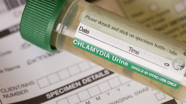 Chlamydia is a sexually transmitted disease caused by <i>Chlamydia trachomatis</i> bacteria. Chlamydia bacterial infections are more common among sexually active teens and young adults.