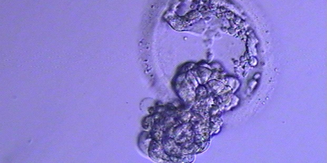 Thawed Embryo Blastocyst Frozen Emgryos not children