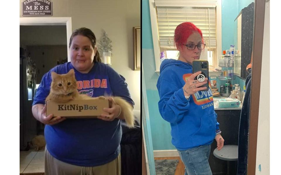 A woman in before and after pictures showing 140 pound weight loss