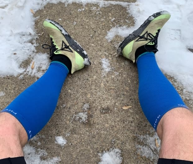 Gibby Davis took this photograph of his very sore feet after running 55 kilometres to finish his self-made 'Birkie Quad' challenge.