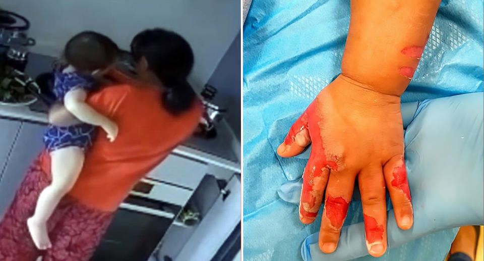 Pictured left is the nanny placing the kids hand inside the pot. Right is the burns on the girl's hand. Source: Newsflash/Australscope