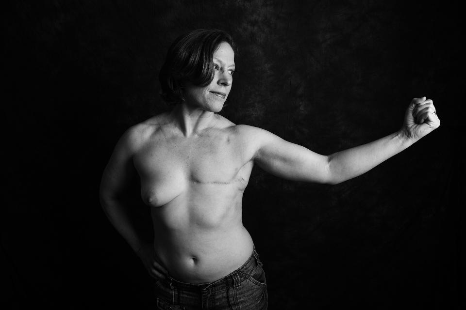 One of sixteen men and women who have bared their scars as part of a project called 'Defiance'.