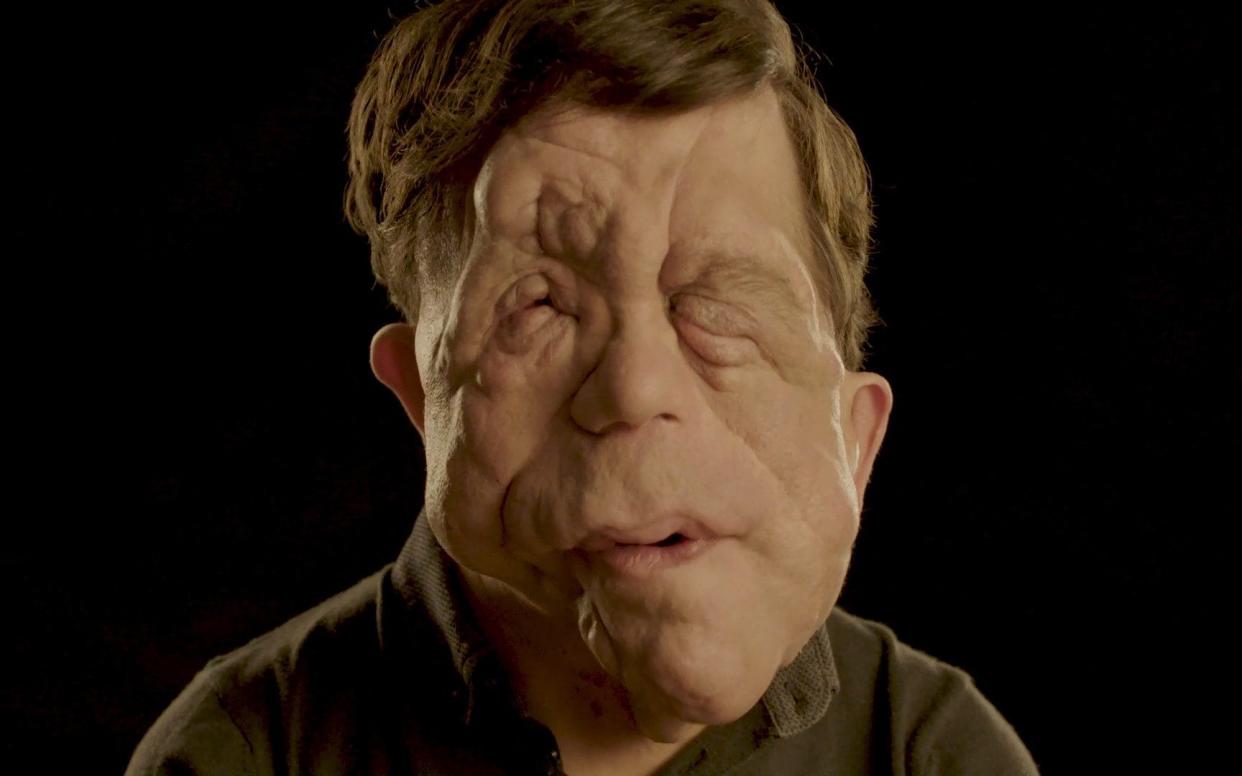 Award-winning campaigner, actor and presenter Adam Pearson, who has neurofibromatosis  - Changing Faces/Changing Faces