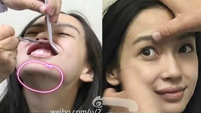 Angelababy曾到整形外科鑑定為純天然美人，卻屢遭不少整形醫師打臉。（圖／翻攝自微博）