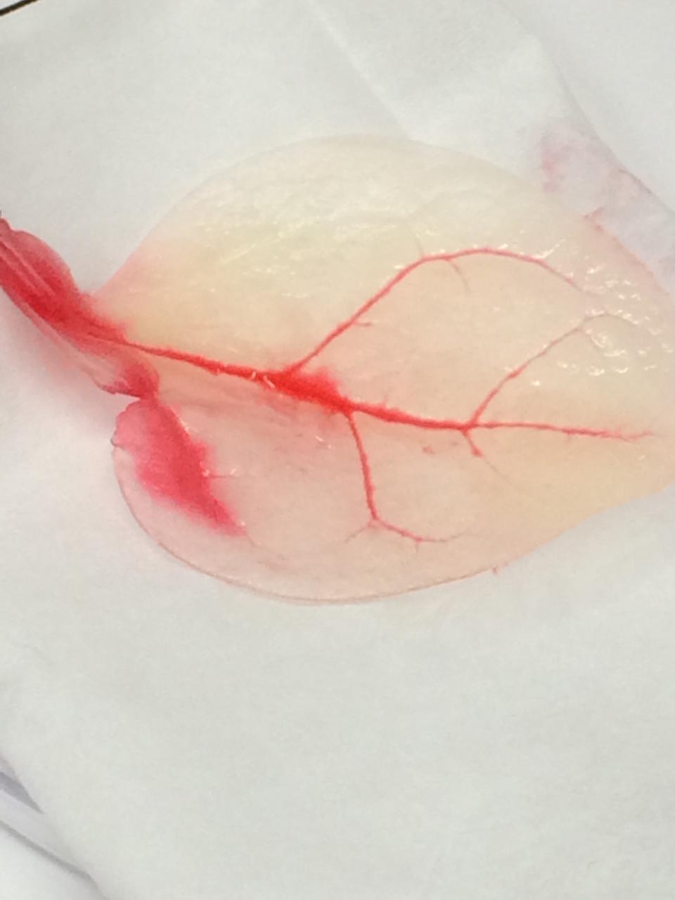 Beating Human Heart Tissue Grown from Spinach Leaves