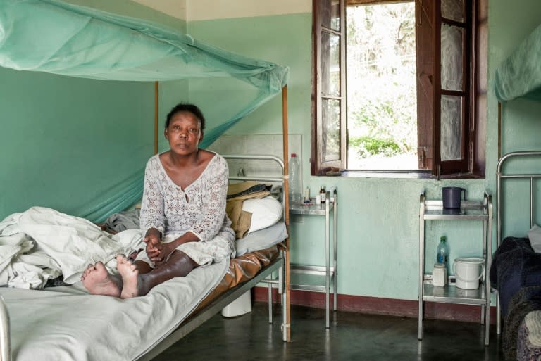 Vololonirina Ranorovelo developed leprosy symptoms more than 10 years ago. Even though leprosy is not very contagious, she will never be able to return to her village because her family and friends will reject her