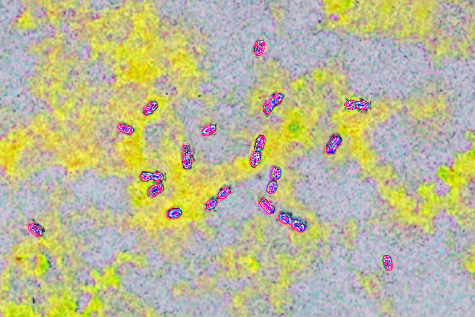 Pneumococcal bacteria (streptococcus pneumoniae). Pneumococcus is an important pathogen in humans. It is responsible for many infections (pneumonia). He was responsible for pneumonia during the Spanish flu pandemic). Visualized by optical microscopy. . (Photo by: CAVALLINI JAMES/BSIP/Universal Images Group via Getty Images)