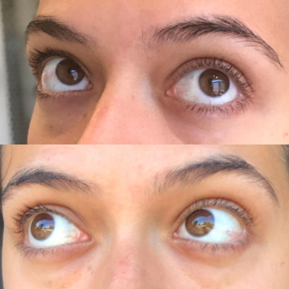 Results of the Radiance Eye Cream after two weeks of use: Week one (left photo), week two (right photo). 